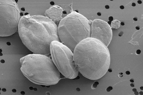 Descubren una nueva especie de microalga tóxica en Canarias